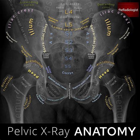 Pelvic Anatomy Mri Labeled Ap Pelvis Xray Anatomy Fem