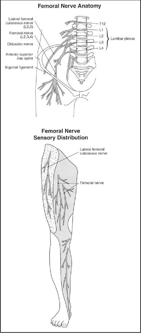 Figure 1 From Femoral Nerve Palsy As A Complication Of Anterior Iliac