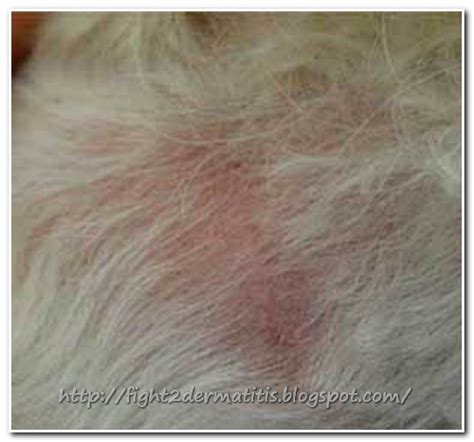 Flea allergy dermatitis (fad) is an eczematous itchy skin disease of dogs and cats. Dermatitis Treatment for Cats | Let us Fight To DERMATITIS