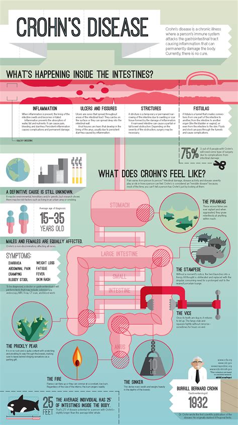 Crohns Disease An Infographic On Behance