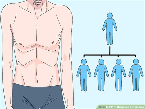 How To Diagnose Lymphoma With Pictures Wikihow