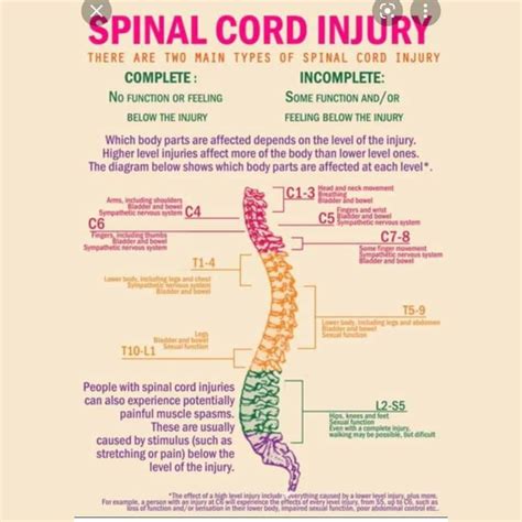 What You Need To Know About Spinal Cord Injury Ubee Nutrition