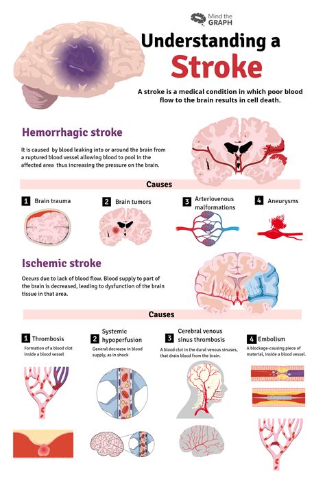 Stroke Symptoms And Risk Factors
