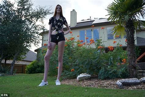 Texas Teenager Crowned Longest Legged Woman In The World And Urges