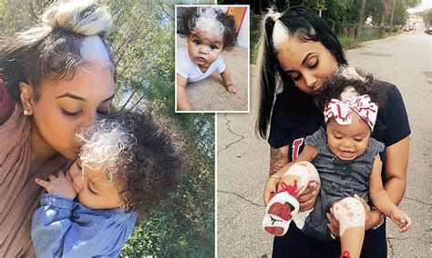 Girl Born With Striking White Streak In Her Hair And It S An Exact Replica Of Her Mum S Daily