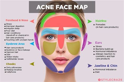 Acne Face Map What Your Breakouts Are Trying To Tell You Face
