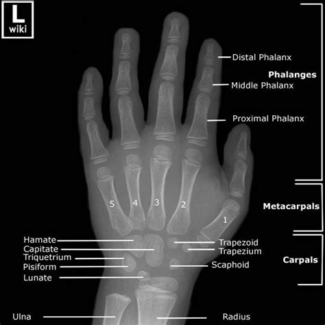 Paediatric Hand Pediatrics Radiology Student Human Muscle Anatomy