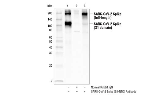 Sars Cov 2 Spike Protein S1 Ntd Antibody Cell Signaling Technology