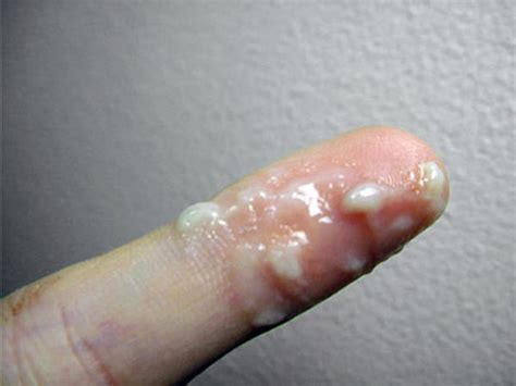 Maybe you would like to learn more about one of these? What cervical mucus looks like: photos - BabyCenter Australia