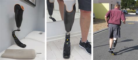 Prosthetics For Sports And Water Activities