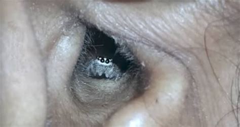Doctors Find Spider Living In Womans Ear Video All That Is