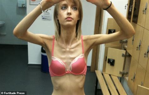 Anorexic Model Reveals How She Quit The Catwalk To Become A Personal Trainer Daily Mail Online