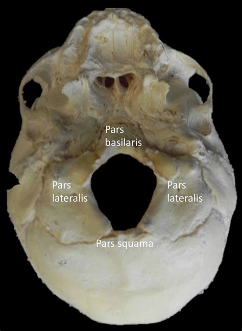 Occipital Bone Foramen Magnum