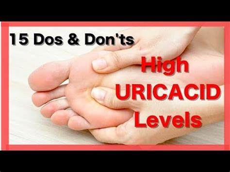 How To Control Uric Acid Top Uric Acid Symptoms Gout Treatment Gout