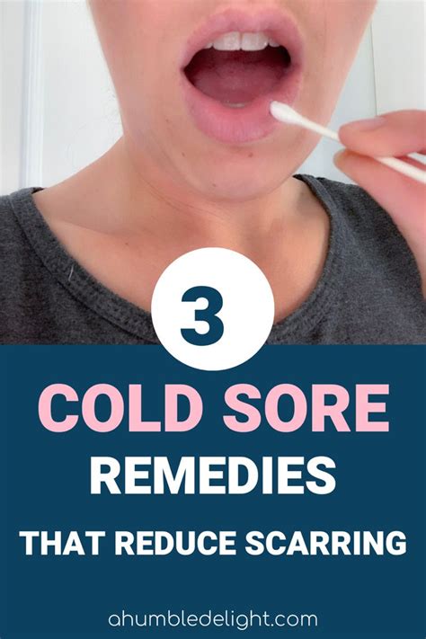 How To Cover Up A Cold Sore Scab On Your Lip Janett Woodson