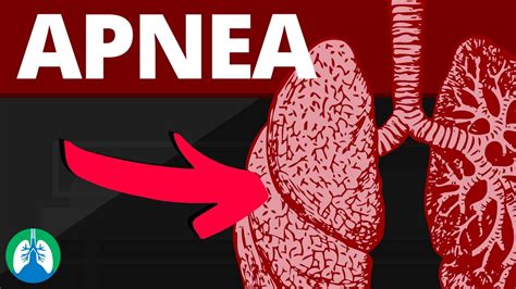Apnea Medical Definition Quick Explainer Video Youtube