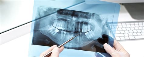 Panoramic X Ray Westgrove Dental