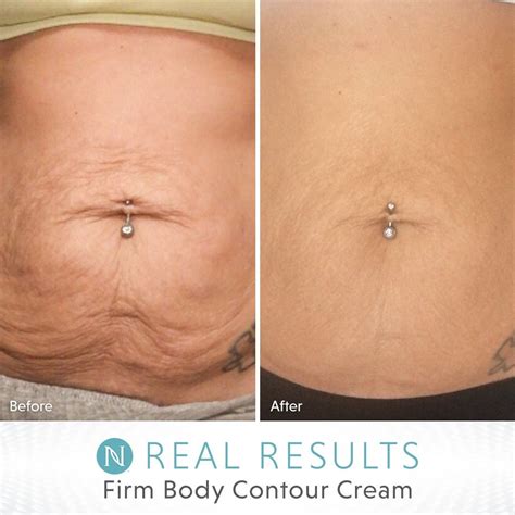 The sunscreen contouring trend is basically using tan lines on your face to create contouring, explains dr. Real 90 day results! (With images) | Body contouring ...