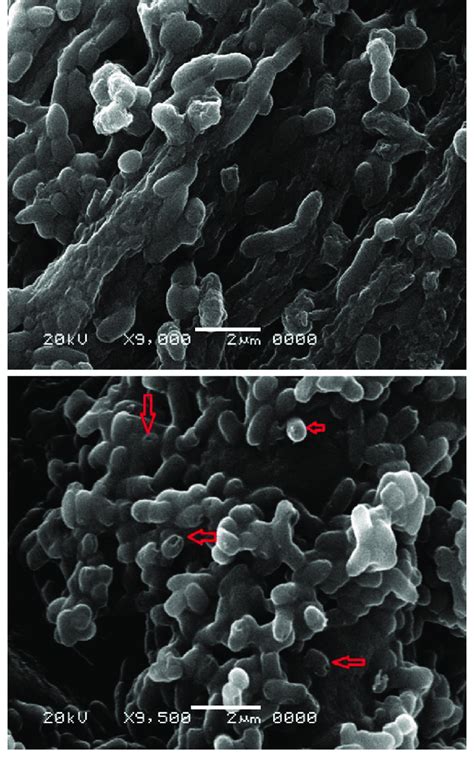 Scanning Electron Microscope Sem Image For Salmonella Enterica