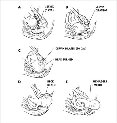 Stages Of Labor And Delivery Pregnancy