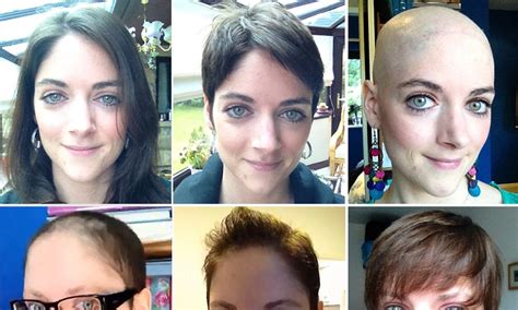My Hair Journey After Chemotherapy Woman 31 Makes Timelapse Video Of