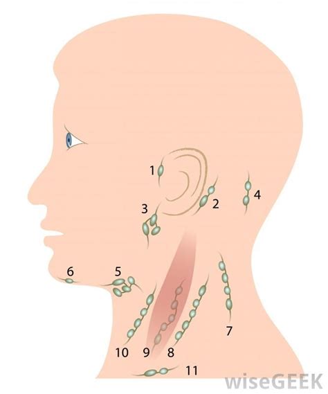 Headache And Swollen Lymph Nodes In Neck Images Aboutheadache