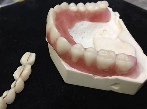 Take back your smile with denturi diy denture kits. Do It Yourself Denture Kit Make Your Own Temporary Denture ...