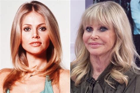 Bond Girl Britt Ekland I Ruined My Face With Lip Fillers