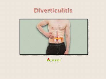 Ppt Diverticulitis Powerpoint Presentation Free Hot Sex Picture