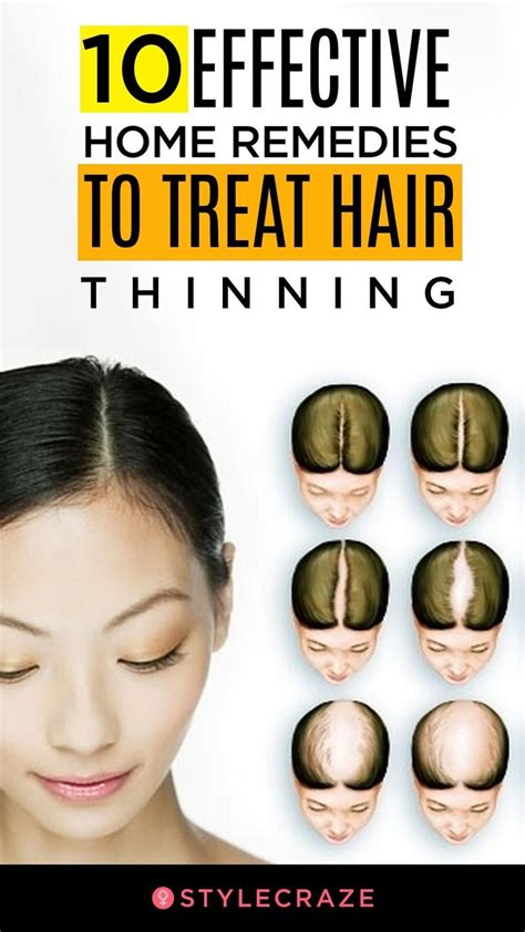 10 Effective Home Remedies To Treat Hair Thinning