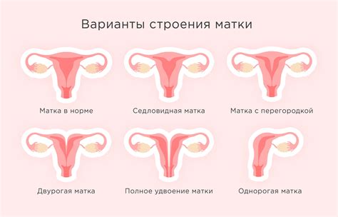 Строение матки 28 фото