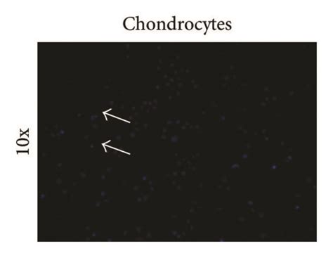 morphology a c and apoptosis assay d i of chondrocytes download scientific diagram