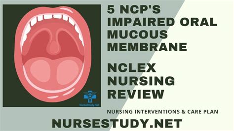 Impaired Oral Mucous Membrane Nursing Diagnosis And Nursing Care Plan