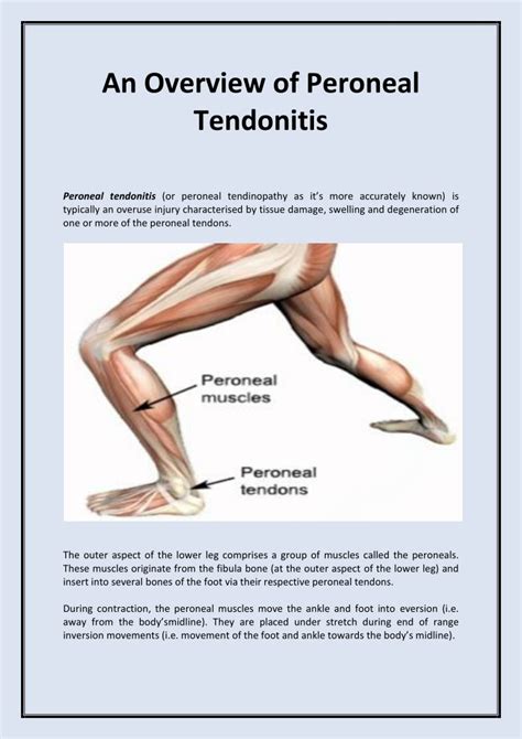 Ppt An Overview Of Peroneal Tendonitis Powerpoint Presentation Free