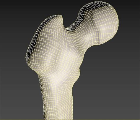 Femur Bone Closed And Sliced 3d Model Cgtrader