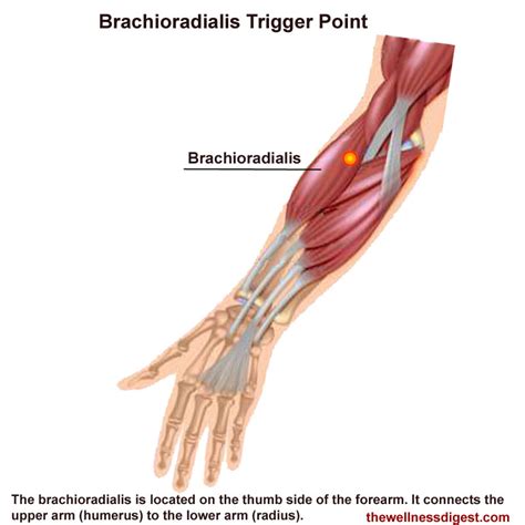 Brachioradialis Muscle Pain The Wellness Digest