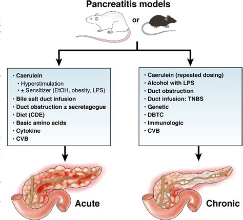 Figure 1 From Models Of Acute And Chronic Pancreatitis Semantic Scholar