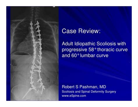 Case Review 13 50 Year Old Female With Progressive Adult Idiopathic
