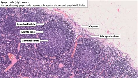 Lymph Node Normal Histology Nus Pathweb Nus Pathweb
