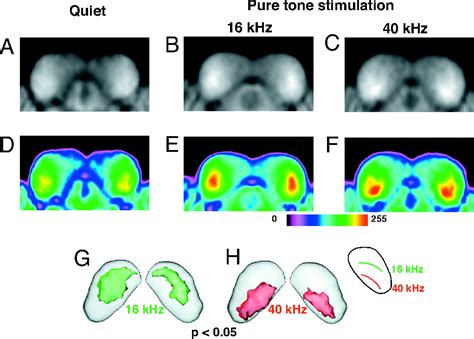 Large Scale Reorganization Of The Tonotopic Map In Mouse Auditory
