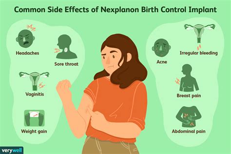 How Nexplanon Birth Control Implant Works And Side Effects