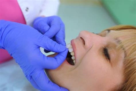 Deciding Between Dental Bonding Vs Veneers A Comprehensive Guide