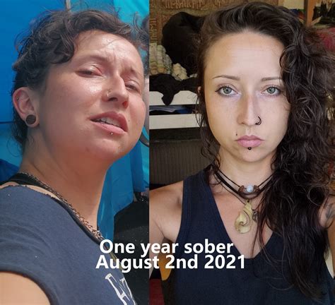 One Year Sober Before And After Stopdrinking