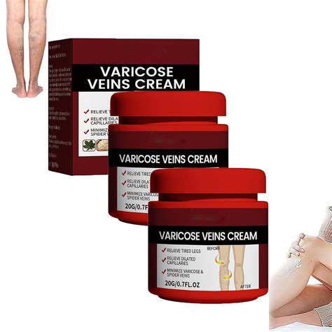 Medilisk Varicose Veins Relief Cream Varicose Veins Treatment For Legs
