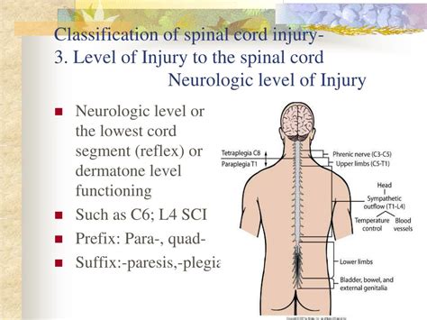 Ppt Traumatic Spinal Cord Injury Powerpoint Presentation Free