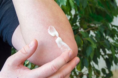 Tapinarof Cream Submitted For Approval For Treatment Of Plaque Psoriasis