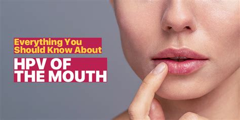 Ammettere Tumore Maligno Superiore Hpv White Spots On Lips Scoraggiare Conoscere Luogo Di Nascita