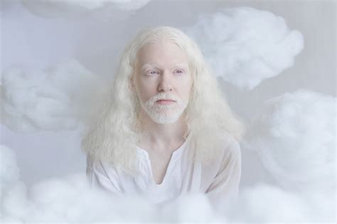 Photographer Captures The Hypnotizing Beauty Of Albino People