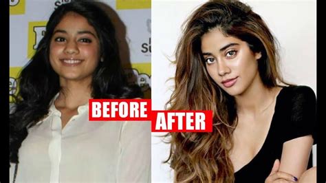Jhanvi Kapoor Before And After Plastic Surgery