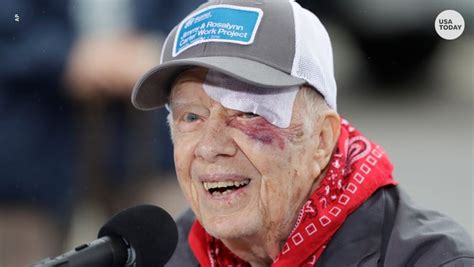 President Jimmy Carter Surgery For Brain Pressure What We Know